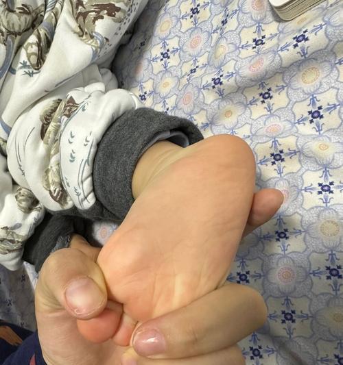 小孩小掌发黄的原因和应对方法（了解小孩小掌发黄的症状与预防措施）